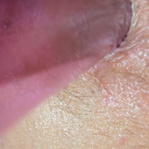 DeKING