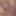 Tinyboydick