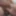 F0reskinl0ver