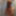 My foreskin
