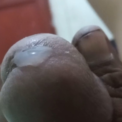 tonggi1