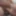 F0reskinl0ver