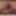 Thumbchoice