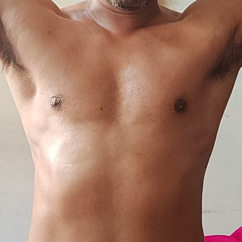 Simple