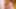 Redhead