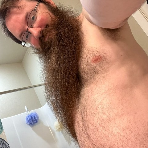 FuzzyBeardBoy
