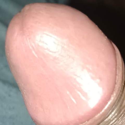 Dickman