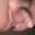 Smooth skin 
