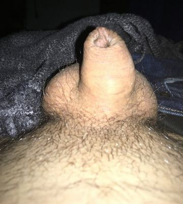 TinyDick